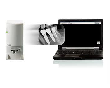 carestream_cs_7200_optimisation Carestream CS 7200 Optimisation