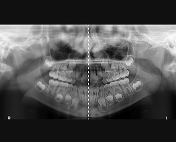 cs_8100_qualite_image
