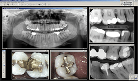 cs_trophy_gestion_imagerie