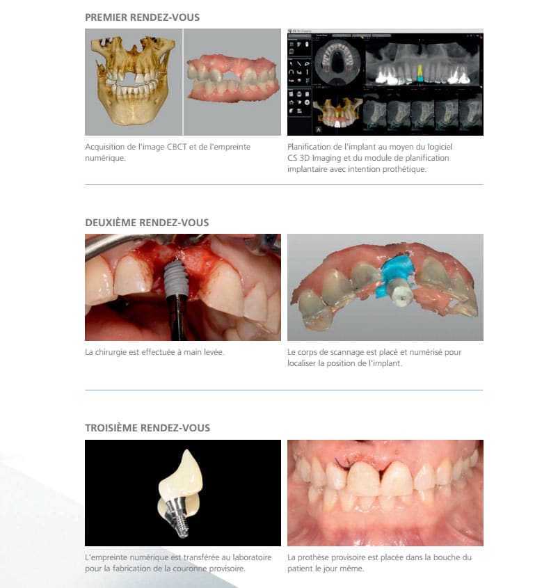 pdip_cs_solutions_for_implants_cas_clinique