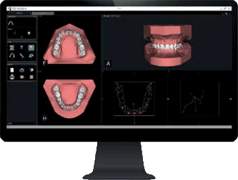 cs_model