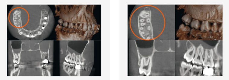 Veraview_X800_reconstruction
