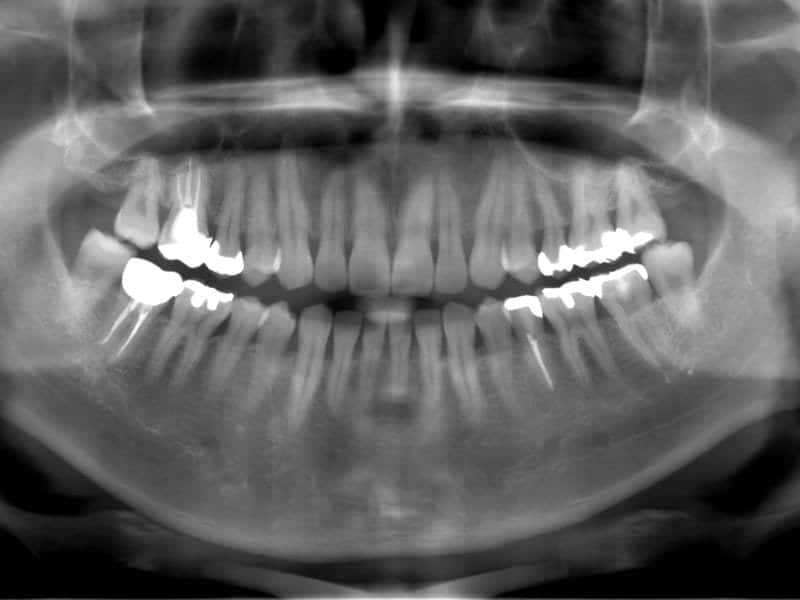 veraview_ic5_hd_resolution