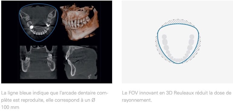 veraviewpocs_3D_R100_3D_reuleaux