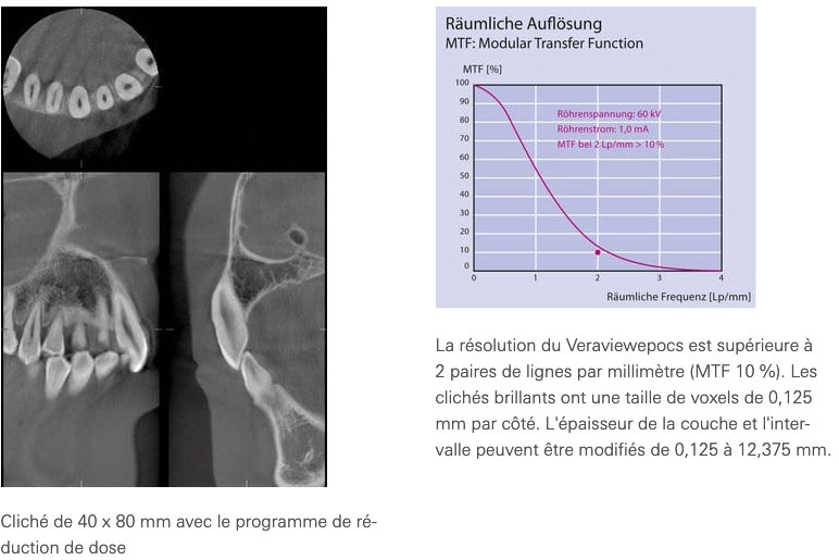 veraviewpocs_3D_R100_dose