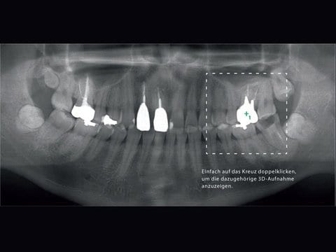 veraviewpocs_3D_R100_positionnement_3D