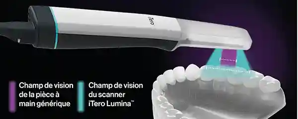 lumina-champ-de-vision